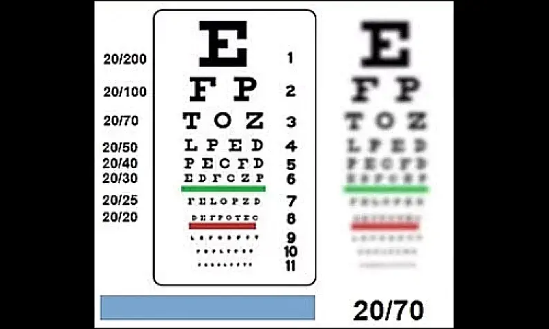 dog blog page spot image for eye test human compared to dog